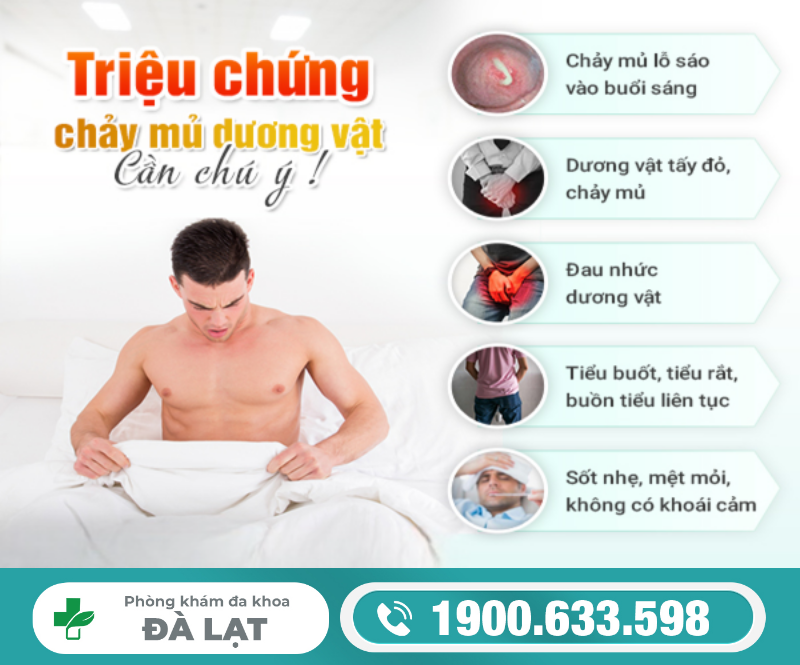 Hình ảnh minh họa